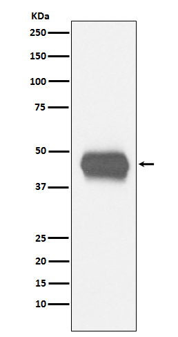 WB - Anti-CD1a Rabbit Monoclonal Antibody ABO15215